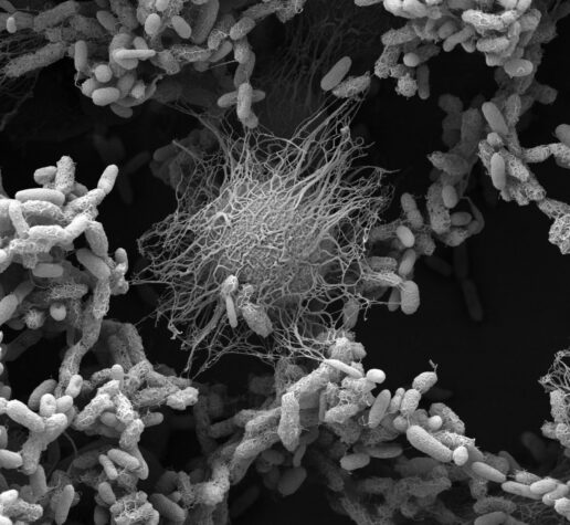 Gray scanning electron microscope image shows a microbial community with empty space, including some that are fuzzy and pill-shaped and some larger that look like balls exuding tendrils.
