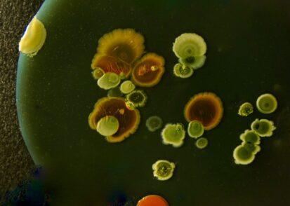 bacterial colonies