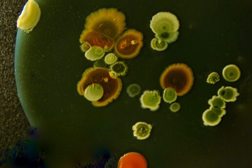 bacterial colonies